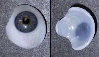義眼機(jī)構(gòu)